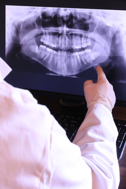 Best Emergency Treatment for Dental Infections or Abscesses in Foster City, CA